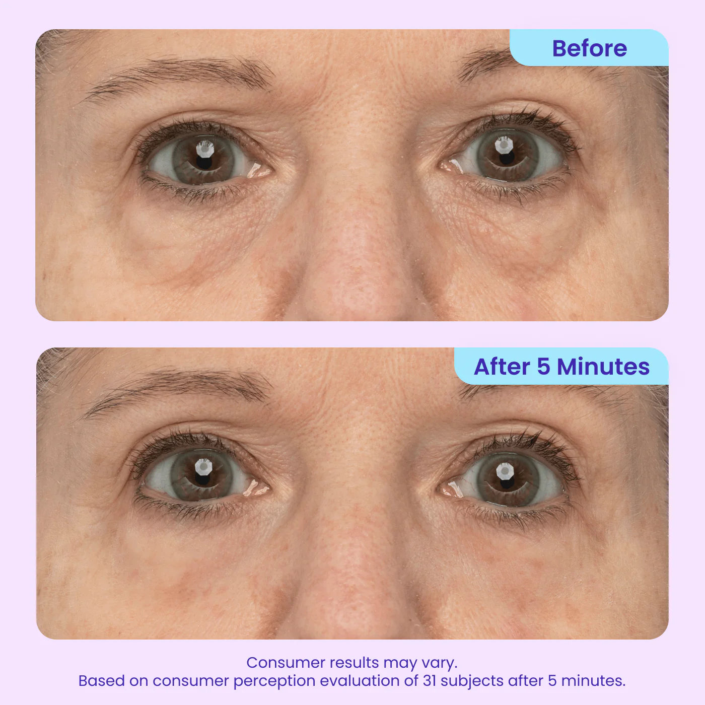 GOPURE - Instant Lift Eye Gel