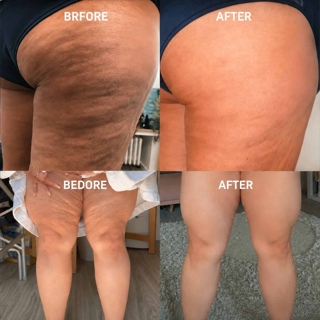 Cryo Thermo Gold — Dual Action Body Firming Gel